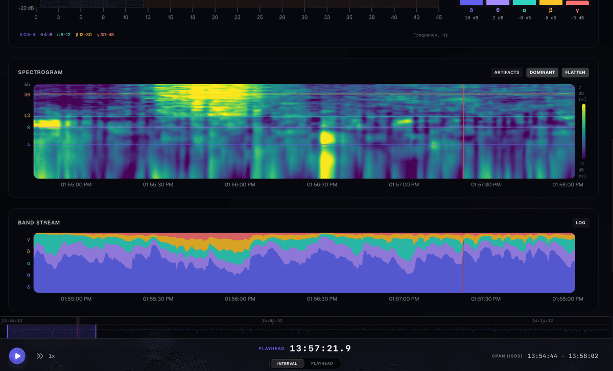 Spectrogram and band stream analysis