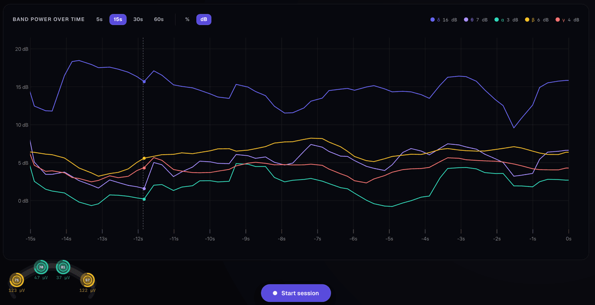 Live band power over time from Muse